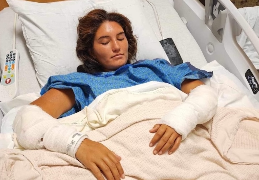 Sabona Tudor recovers in a hospital bed at Hennepin County Medical Center, with both arms bandaged, following a dog attack in Eden Prairie on Aug. 16, 2023. Submitted photo